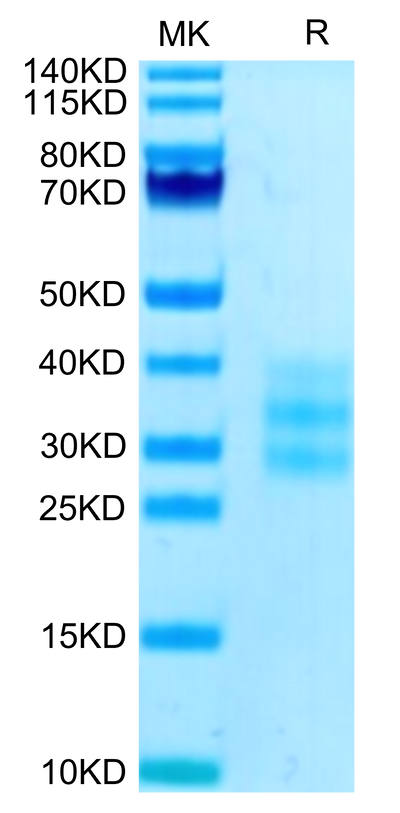 Human FLT3 Ligand on Tris-Bis PAGE under reduced condition. The purity is greater than 95%.Recombinant Human FLT3 Ligand Protein, Active