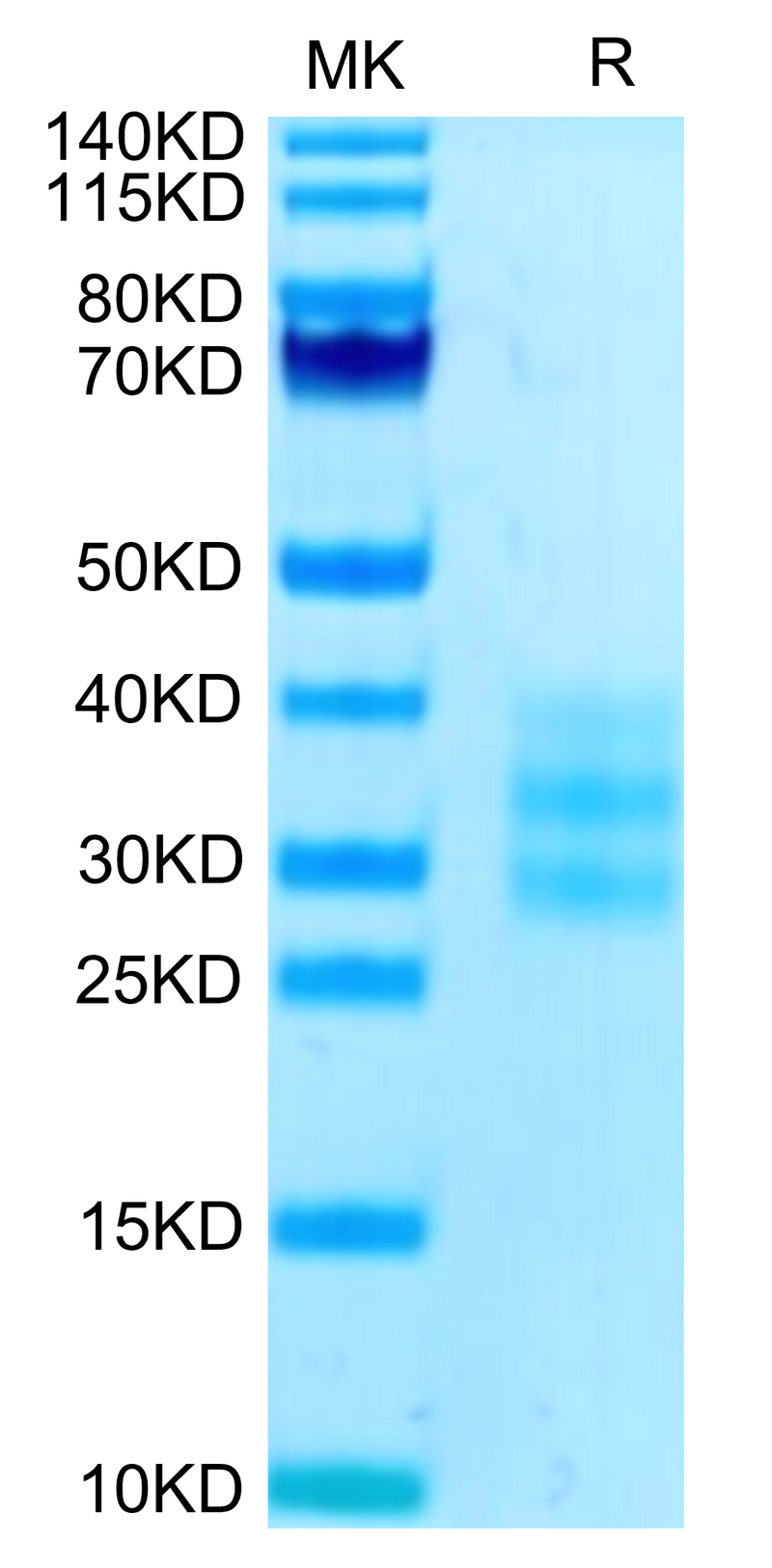 Human FLT3 Ligand on Tris-Bis PAGE under reduced condition. The purity is greater than 95%.Recombinant Human FLT3 Ligand Protein, Active