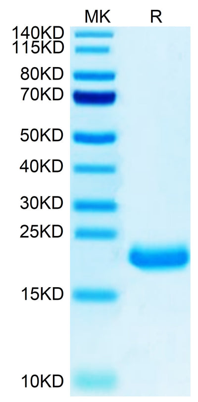 Human MOG on Tris-Bis PAGE under reduced condition. The purity is greater than 95%.Recombinant Human MOG/Myelin Oligodendrocyte Glycoprotein Protein