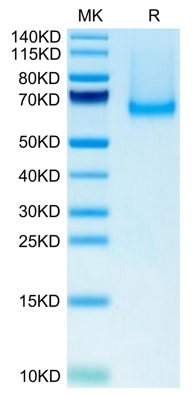 Mouse Siglec-5/CD170 on Tris-Bis PAGE under reduced condition. The purity is greater than 95%.Recombinant Mouse Siglec-5/CD170 Protein