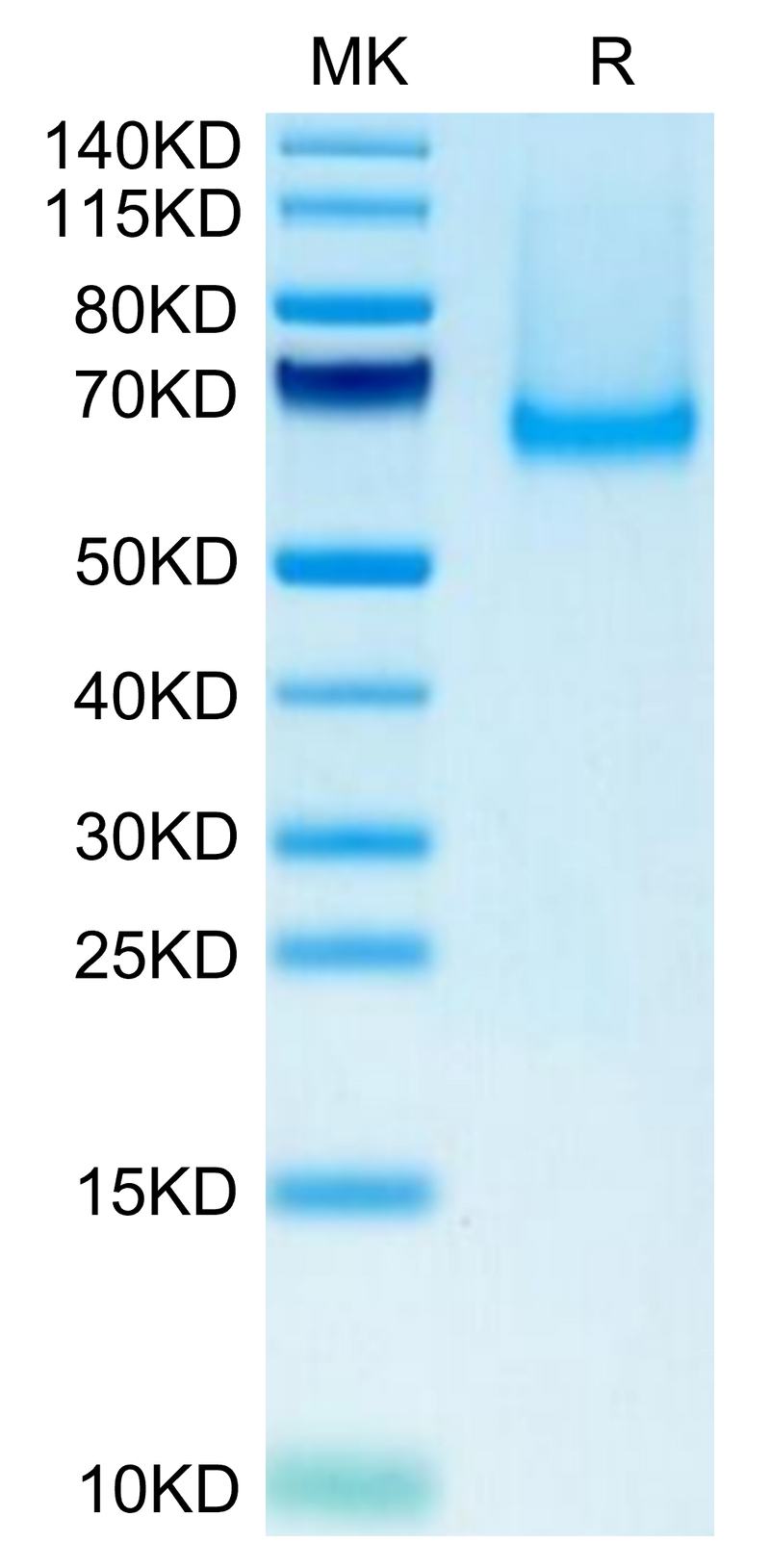 Mouse Siglec-5/CD170 on Tris-Bis PAGE under reduced condition. The purity is greater than 95%.Recombinant Mouse Siglec-5/CD170 Protein