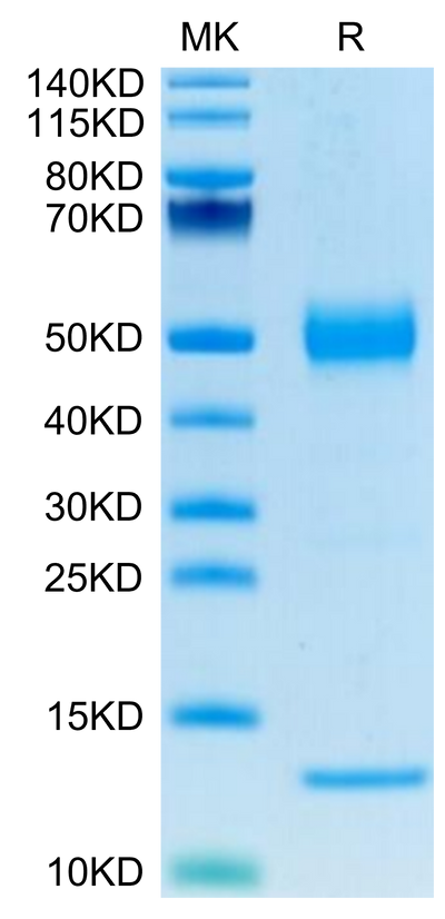 Human CD1A on Tris-Bis PAGE under reduced condition. The purity is greater than 95%.Recombinant Human CD1A Protein