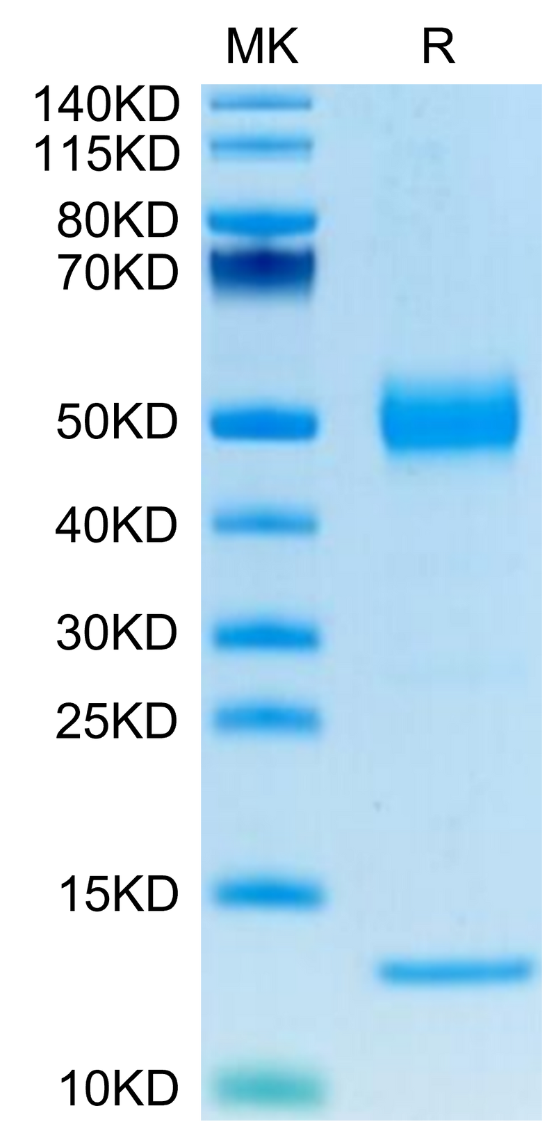 Human CD1A on Tris-Bis PAGE under reduced condition. The purity is greater than 95%.Recombinant Human CD1A Protein