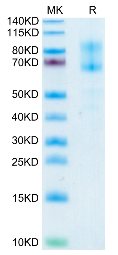 Human IL-2 R beta&IL-2 R gamma on Tris-Bis PAGE under reduced condition. The purity is greater than 95%.Recombinant Human IL-2 R beta&IL-2 R gamma Protein, Active