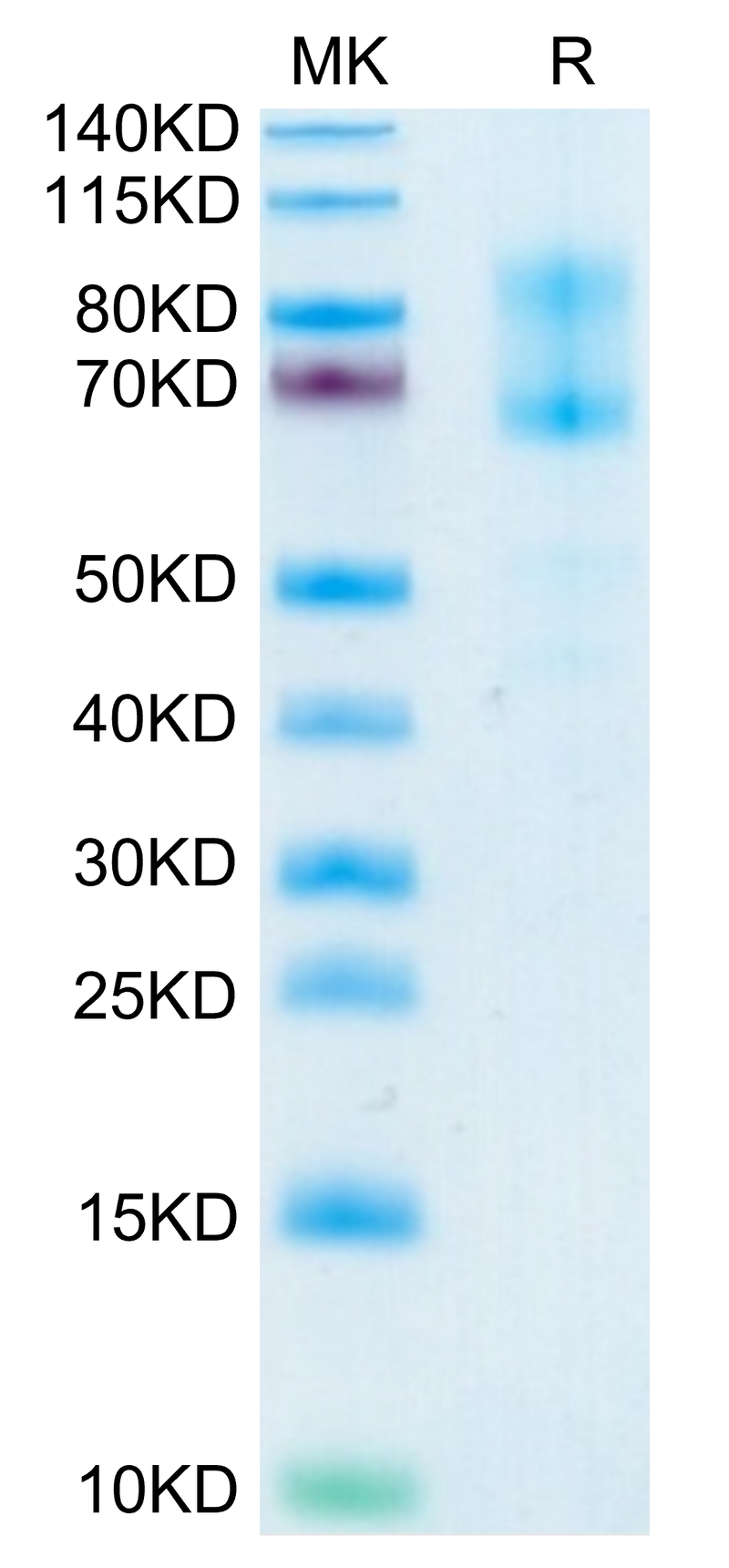 Human IL-2 R beta&IL-2 R gamma on Tris-Bis PAGE under reduced condition. The purity is greater than 95%.Recombinant Human IL-2 R beta&IL-2 R gamma Protein, Active