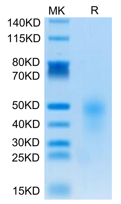 Human CD28H on Tris-Bis PAGE under reduced condition. The purity is greater than 95%.Recombinant Human CD28H/IGPR-1 Protein, Active