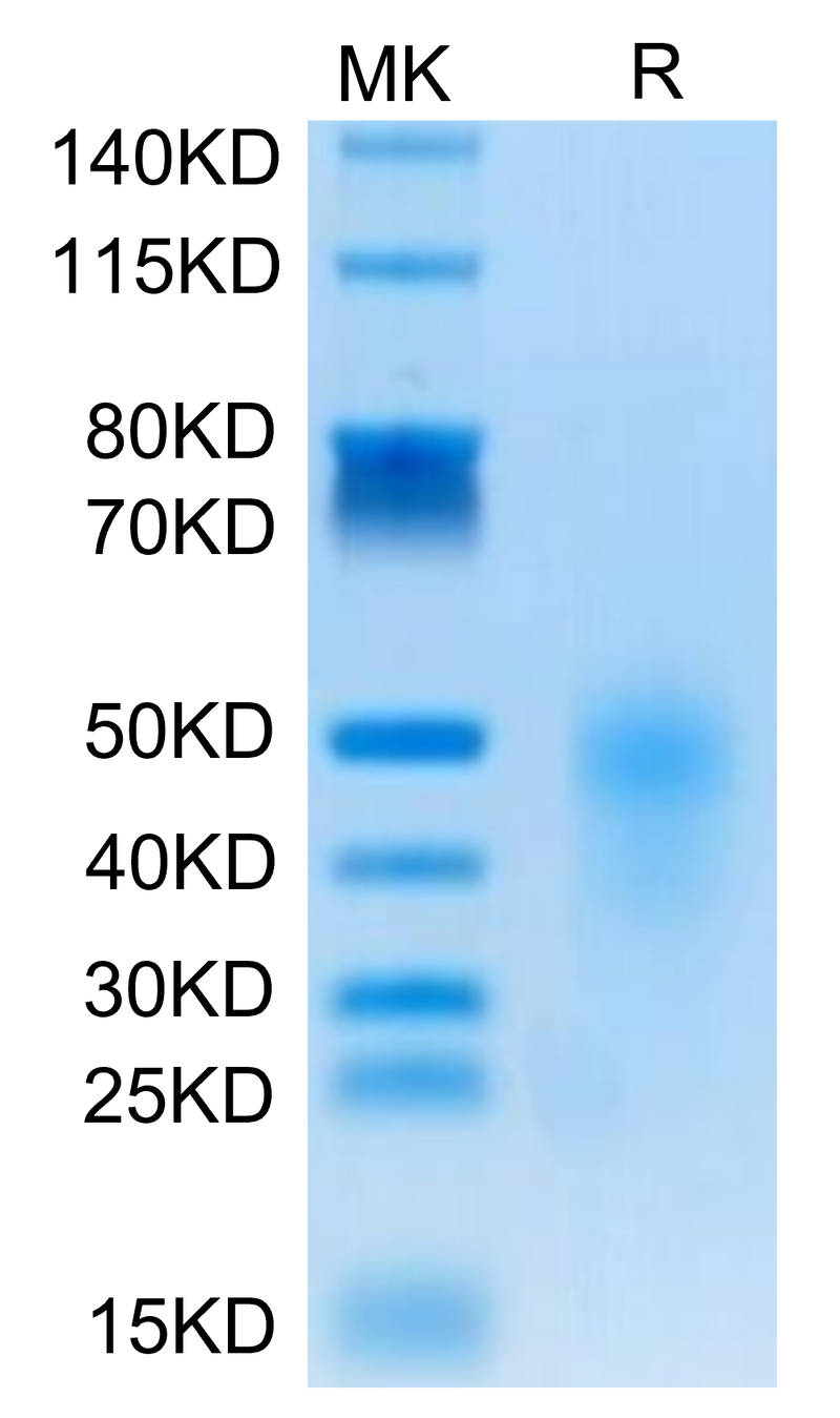 Human CD28H on Tris-Bis PAGE under reduced condition. The purity is greater than 95%.