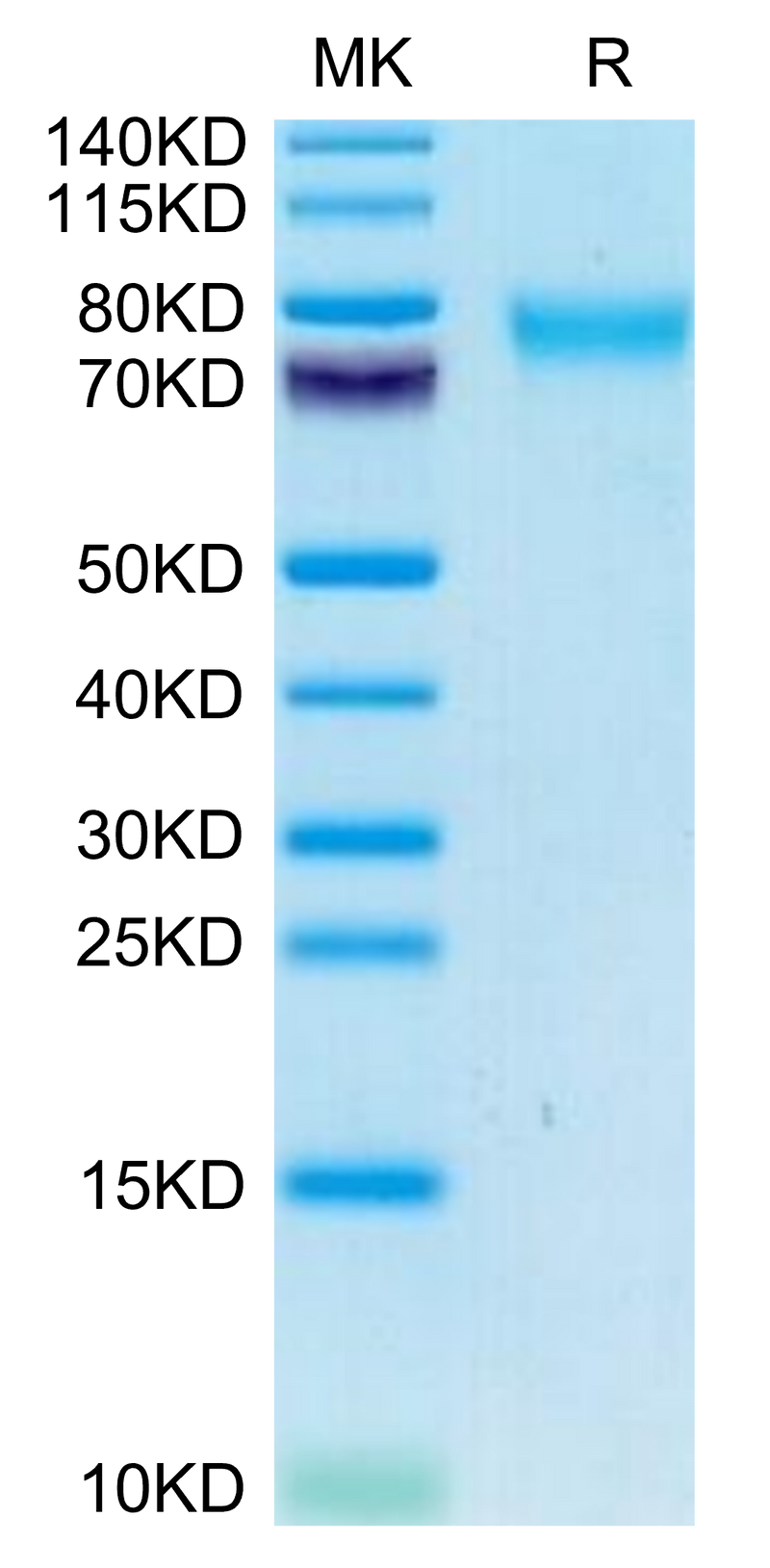 Canine GUCY2C/Guanylyl cyclase C on Tris-Bis PAGE under reduced condition. The purity is greater than 95%.Recombinant Canine GUCY2C/Guanylyl cyclase C Protein