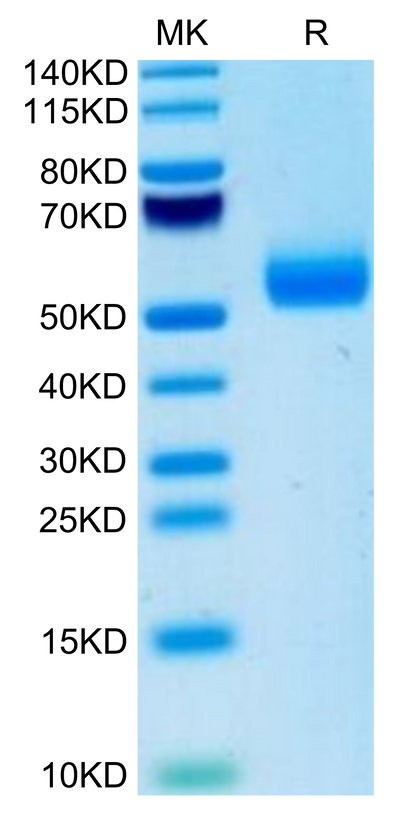 Mouse IgE on Tris-Bis PAGE under reduced condition. The purity is greater than 95%.Recombinant Mouse IgE Protein