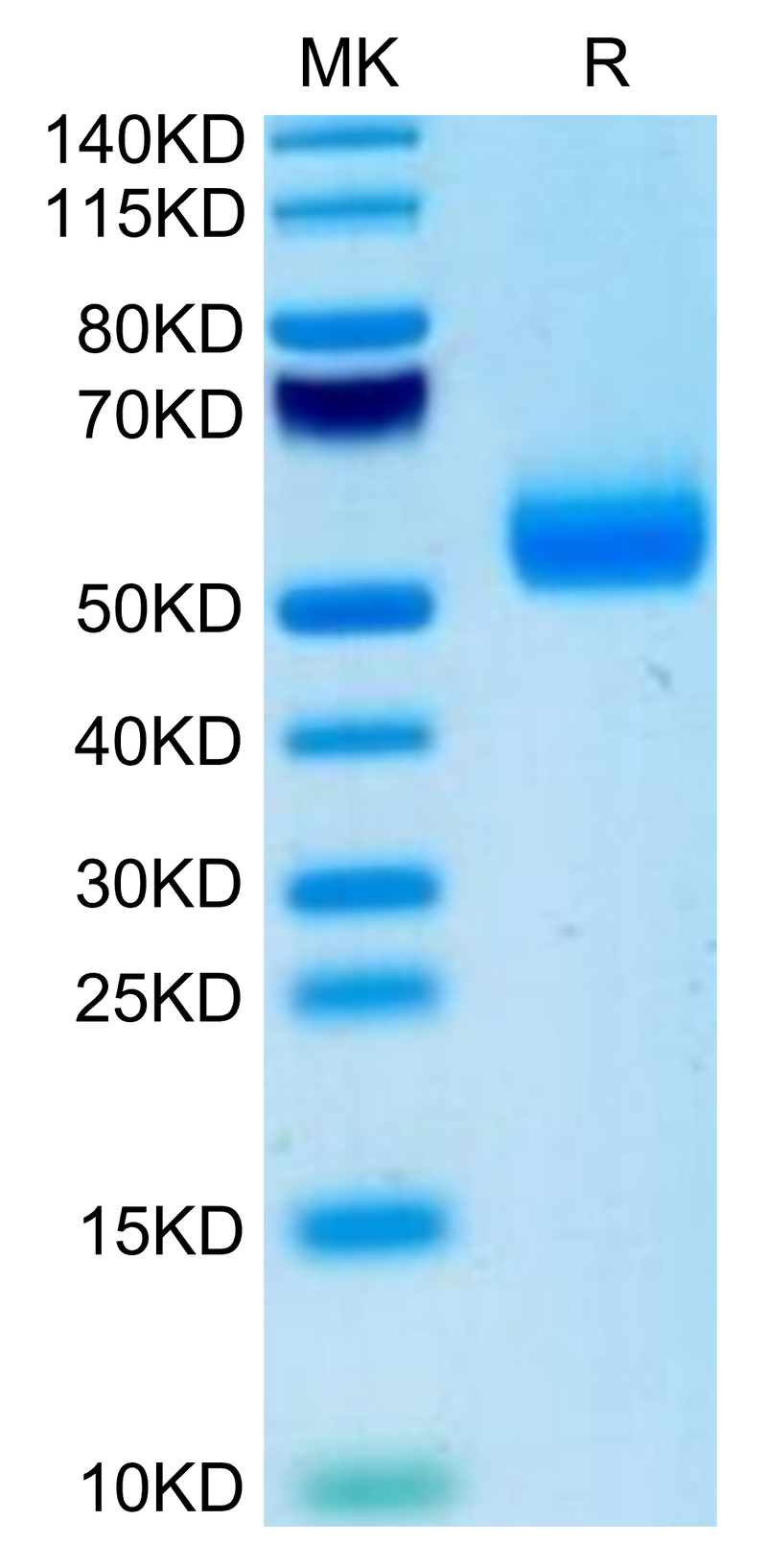 Mouse IgE on Tris-Bis PAGE under reduced condition. The purity is greater than 95%.Recombinant Mouse IgE Protein