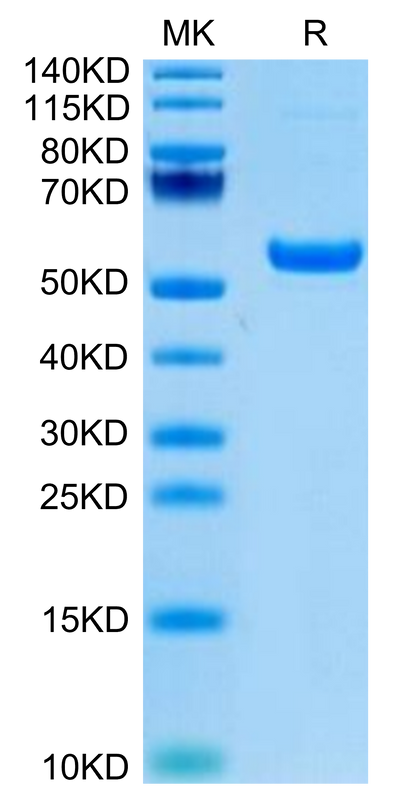 Rhesus macaque CD5 on Tris-Bis PAGE under reduced condition. The purity is greater than 95%.Recombinant Rhesus macaque CD5 Protein, Active