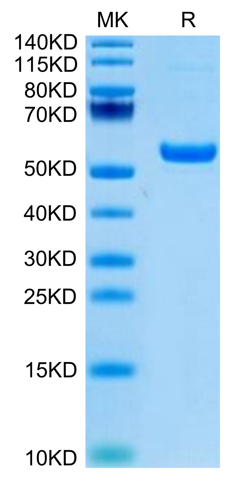Rhesus macaque CD5 on Tris-Bis PAGE under reduced condition. The purity is greater than 95%.Recombinant Rhesus macaque CD5 Protein, Active