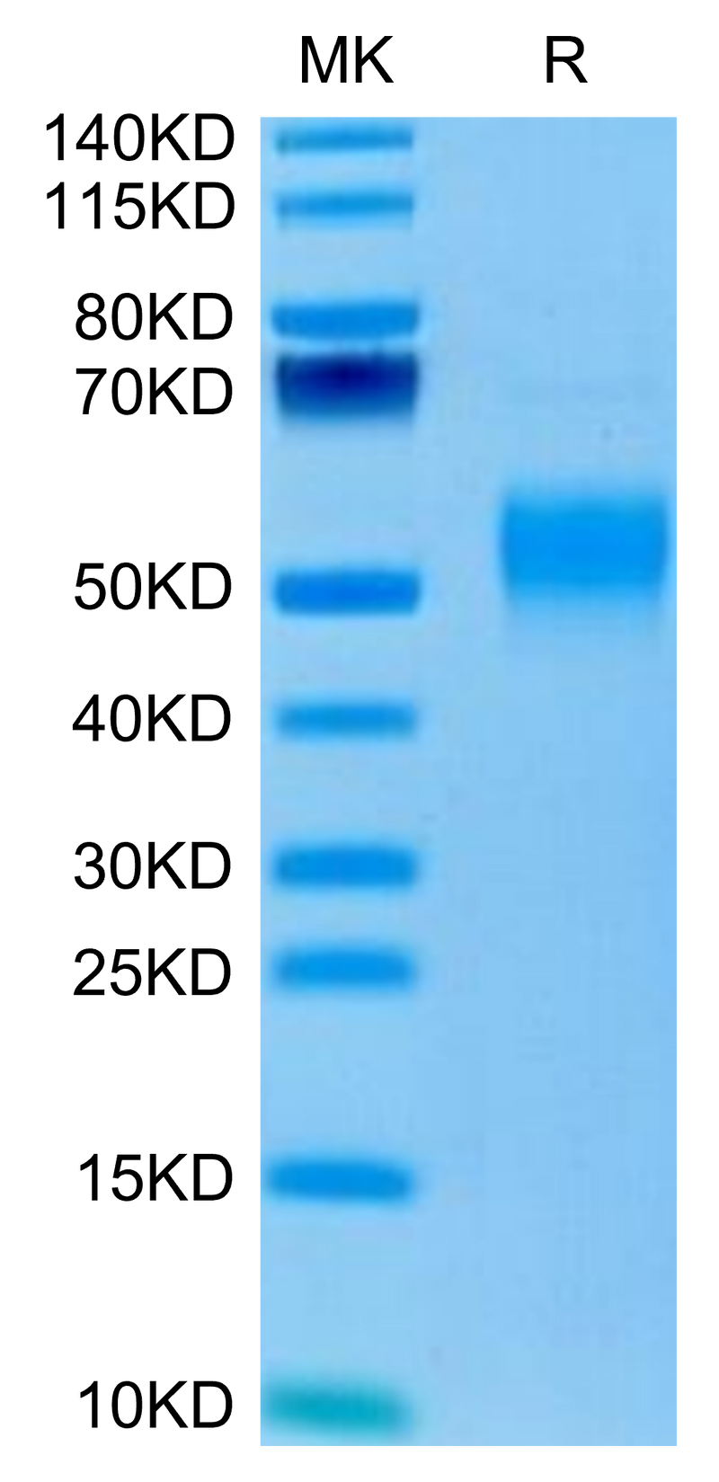 Mouse Fc gamma RI on Tris-Bis PAGE under reduced condition. The purity is greater than 95%.Recombinant Mouse Fc gamma RI/CD64 Protein, Active