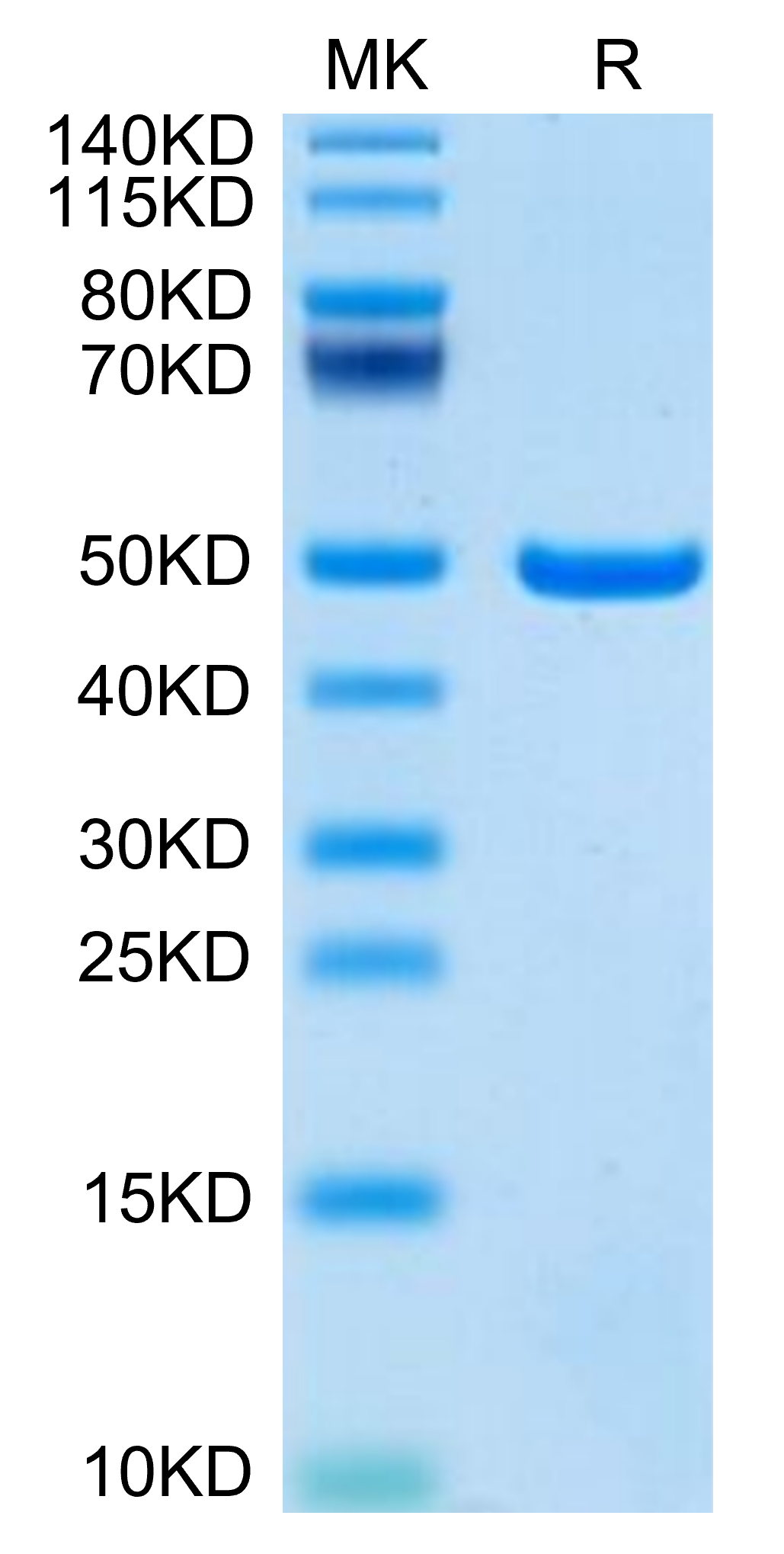 Recombinant Mouse ASPH Protein - High Quality | Beta LifeScience