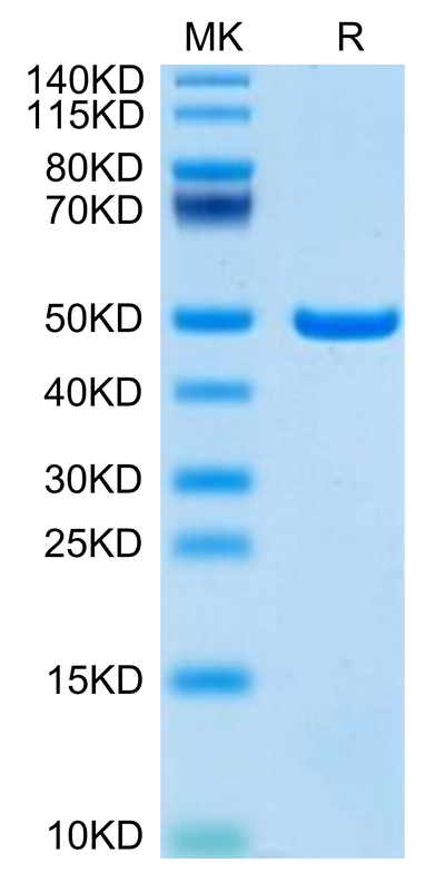 Mouse ASPH on Tris-Bis PAGE under reduced condition. The purity is greater than 95%.Recombinant Mouse ASPH Protein