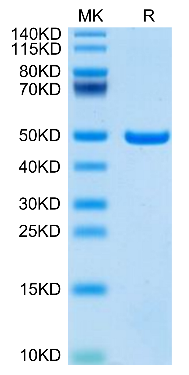Mouse ASPH on Tris-Bis PAGE under reduced condition. The purity is greater than 95%.Recombinant Mouse ASPH Protein