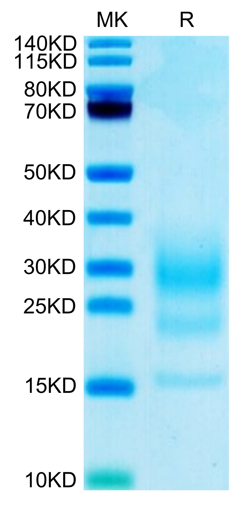 Biotinylated Mouse IL-5 on Tris-Bis PAGE under reduced condition. The purity is greater than 95%.Biotinylated Mouse IL-5 Protein, Active