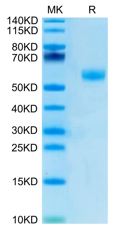 Cynomolgus/Rhesus macaque AMHRII on Bis-Tris PAGE under reduced condition. The purity is greater than 95%.Recombinant Cynomolgus/Rhesus macaque AMHRII Protein, Active