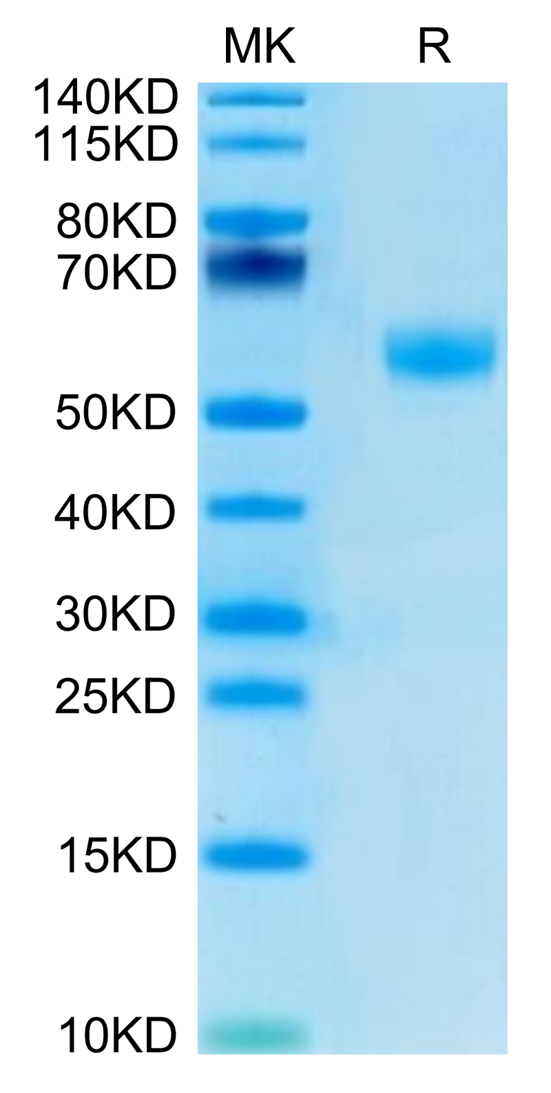 Cynomolgus/Rhesus macaque AMHRII on Bis-Tris PAGE under reduced condition. The purity is greater than 95%.Recombinant Cynomolgus/Rhesus macaque AMHRII Protein, Active