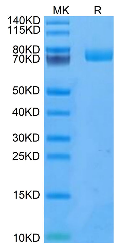 Human uPAR on Tris-Bis PAGE under reduced condition. The purity is greater than 95%.Recombinant Human uPAR/PLAUR Protein, Active