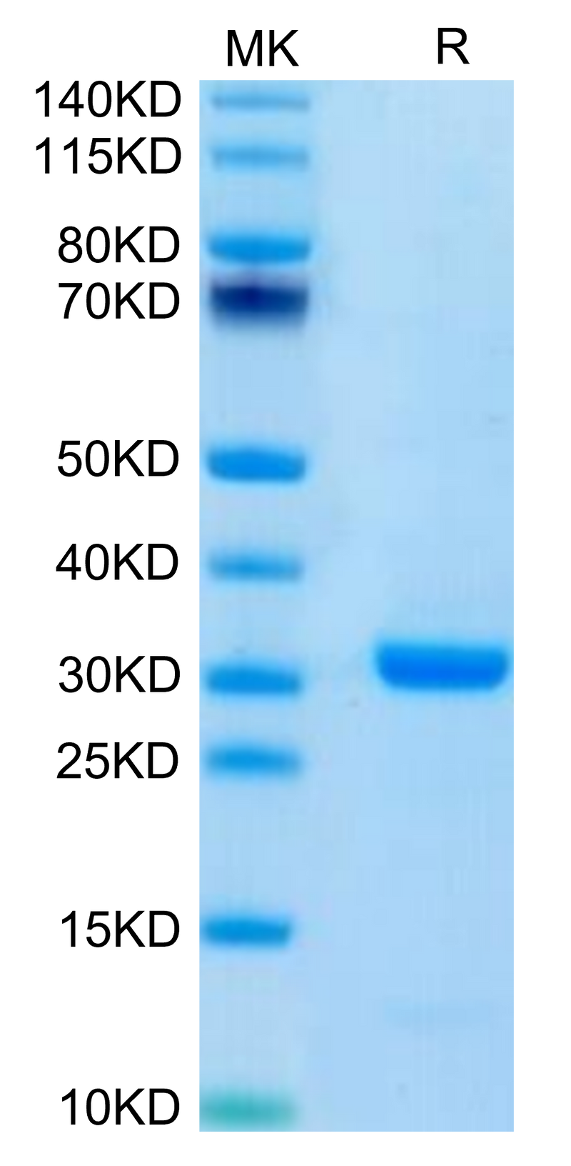 Human FOLR4 on Tris-Bis PAGE under reduced condition. The purity is greater than 95%.Recombinant Human FOLR4/Juno Protein