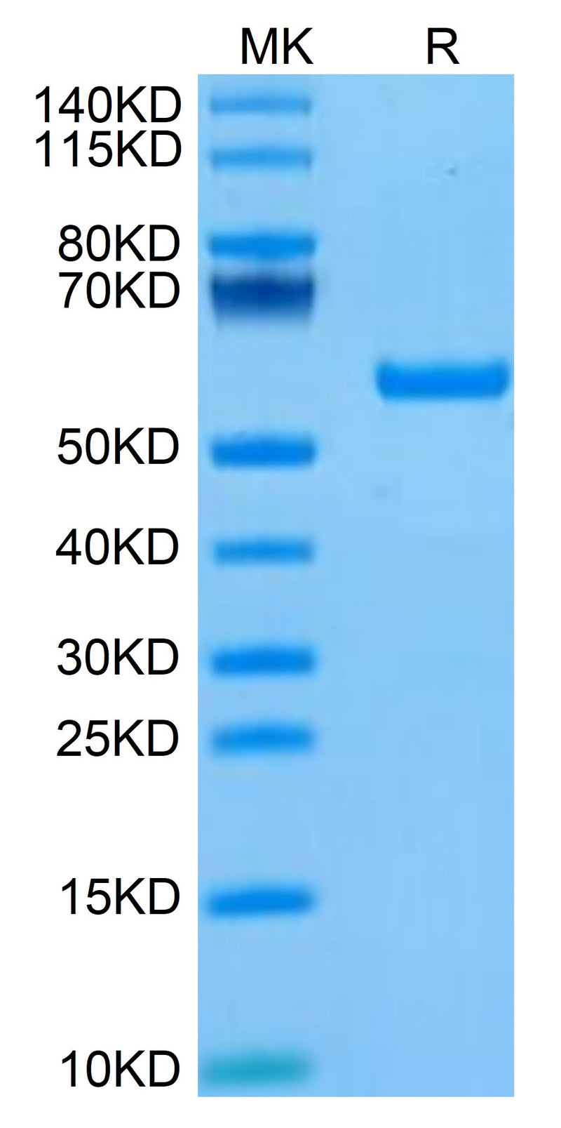 Biotinylated Human HLA-A*11:01&B2M&KRAS G12V (VVGAVGVGK) Monomer on Tris-Bis PAGE under reduced condition. The purity is greater than 95%.Biotinylated Human HLA-A*11:01&B2M&KRAS G12V (VVGAVGVGK) Monomer Protein