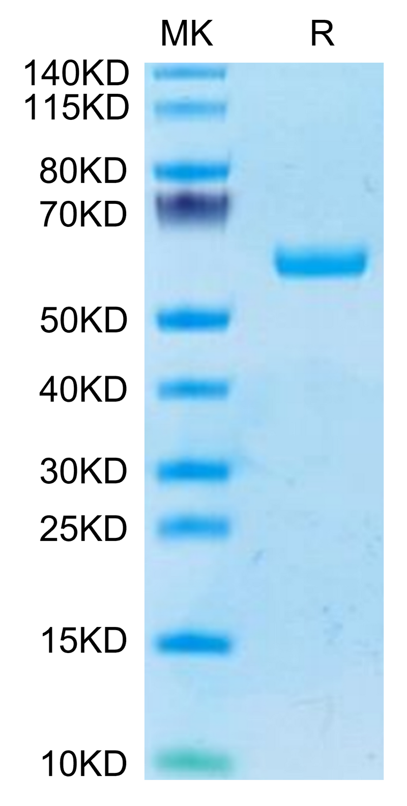 Human BTN3A1 on Tris-Bis PAGE under reduced condition. The purity is greater than 95%.Recombinant Human BTN3A1/CD277 Protein, Active