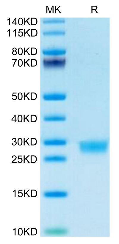 Mouse IL-2 on Tris-Bis PAGE under reduced condition. The purity is greater than 95%.Recombinant Mouse IL-2 Protein, Active