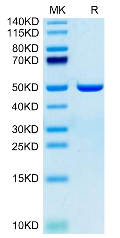 Human ASPH on Tris-Bis PAGE under reduced condition. The purity is greater than 95%.Recombinant Human ASPH Protein
