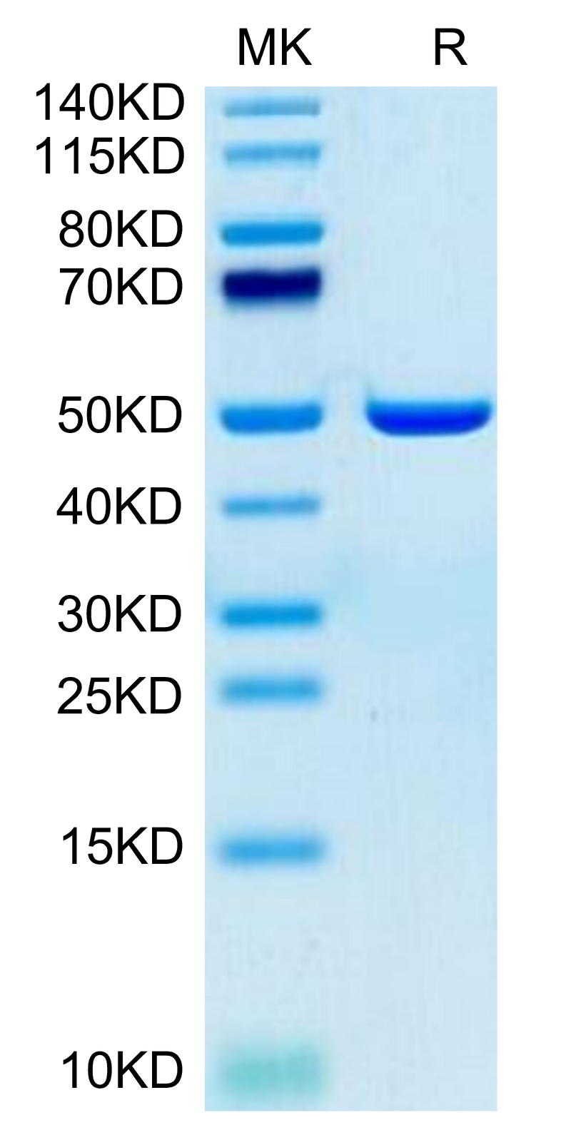 Human ASPH on Tris-Bis PAGE under reduced condition. The purity is greater than 95%.Recombinant Human ASPH Protein