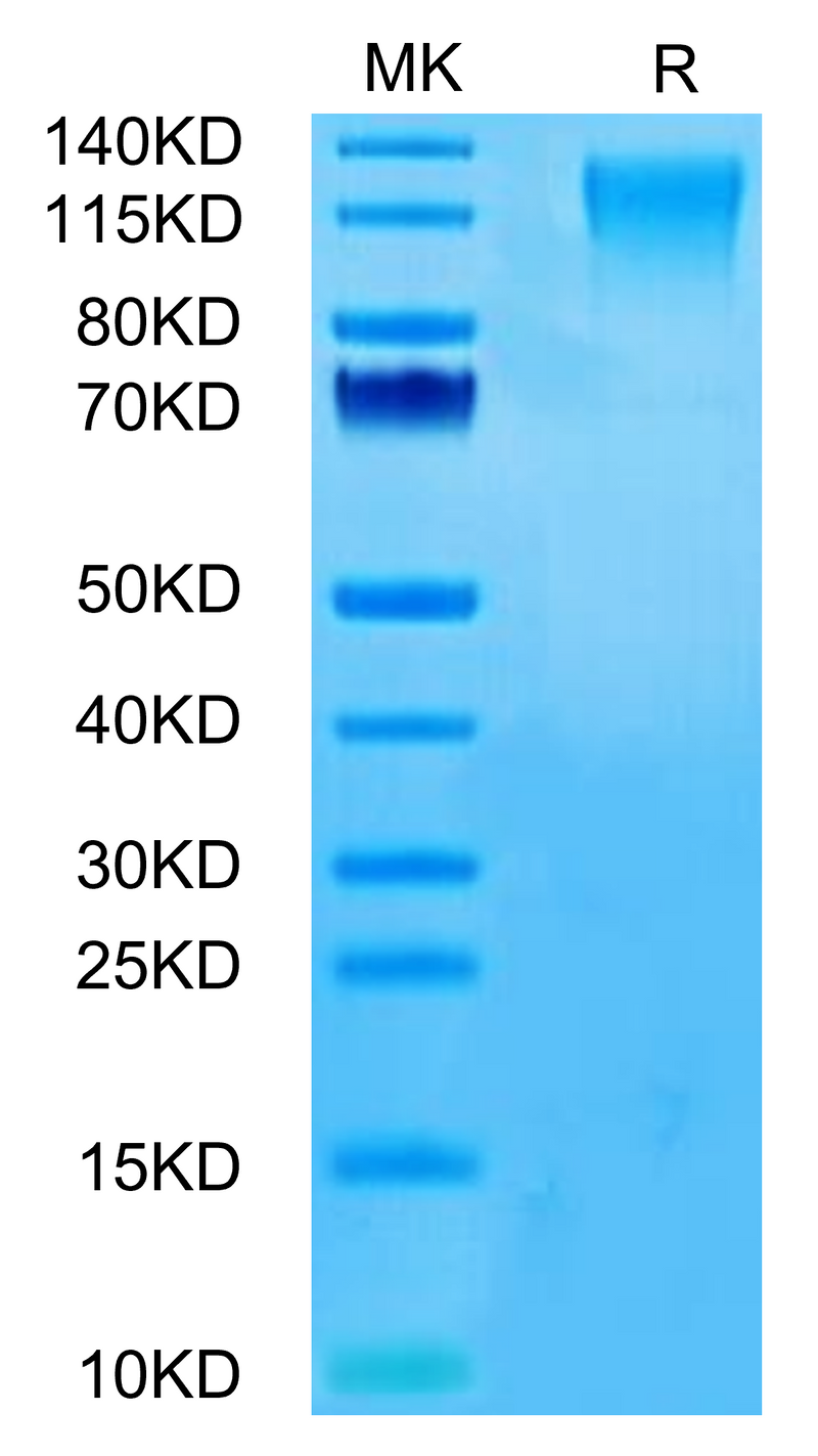 Human CD96 on Tris-Bis PAGE under reduced condition. The purity is greater than 95%.Recombinant Human CD96/TACTILE Protein, Active