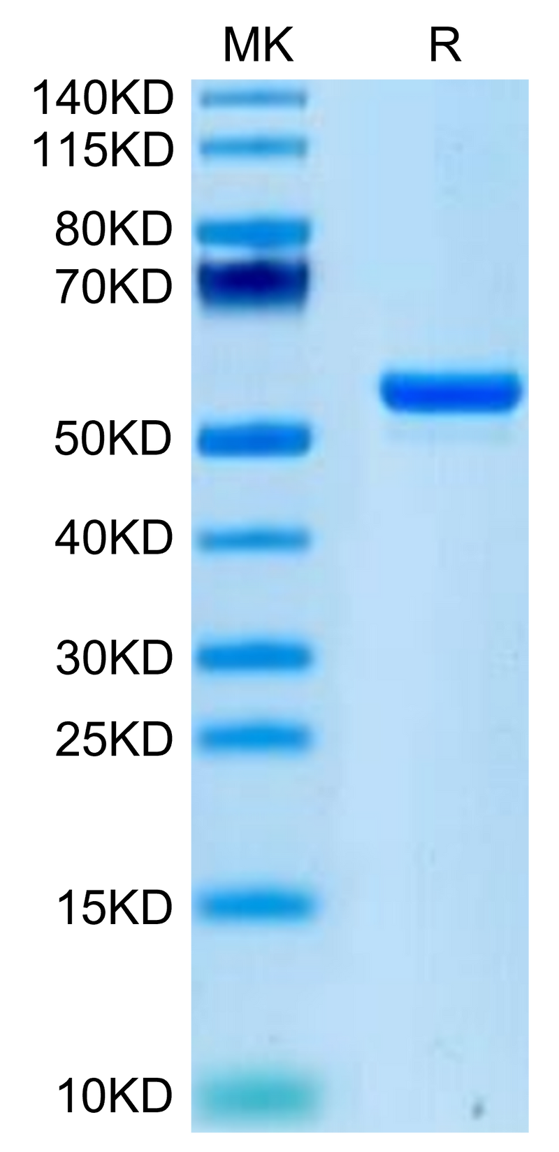Human LIGHT on Tris-Bis PAGE under reduced condition. The purity is greater than 95%.Recombinant Human LIGHT/TNFSF14 Protein, Active