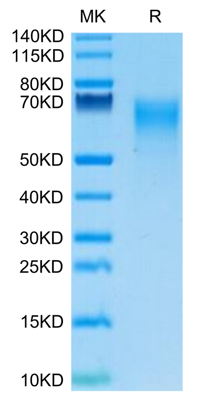 Human IL-17R alpha on Tris-Bis PAGE under reduced condition. The purity is greater than 95%.Recombinant Human IL-17R alpha/CD217 Protein, Active