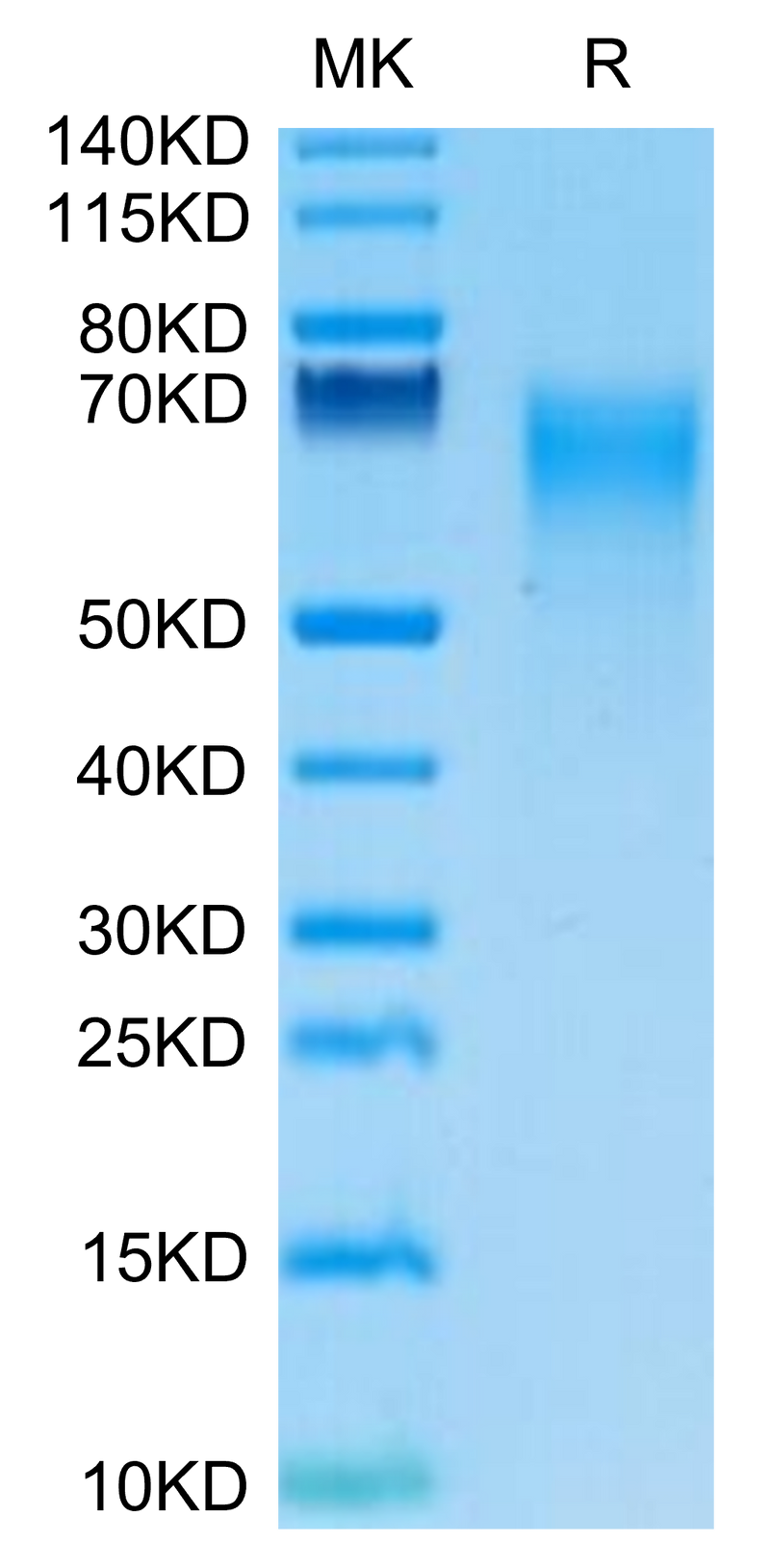 Human IL-17R alpha on Tris-Bis PAGE under reduced condition. The purity is greater than 95%.Recombinant Human IL-17R alpha/CD217 Protein, Active