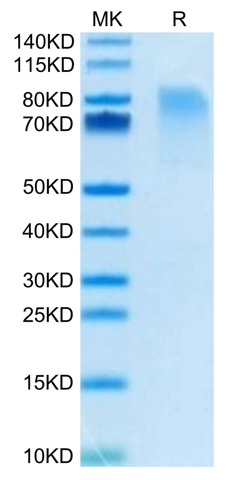 Biotinylated Mouse CX3CL1 on Tris-Bis PAGE under reduced condition. The purity is greater than 95%.Biotinylated Mouse CX3CL1/Fractalkine Protein