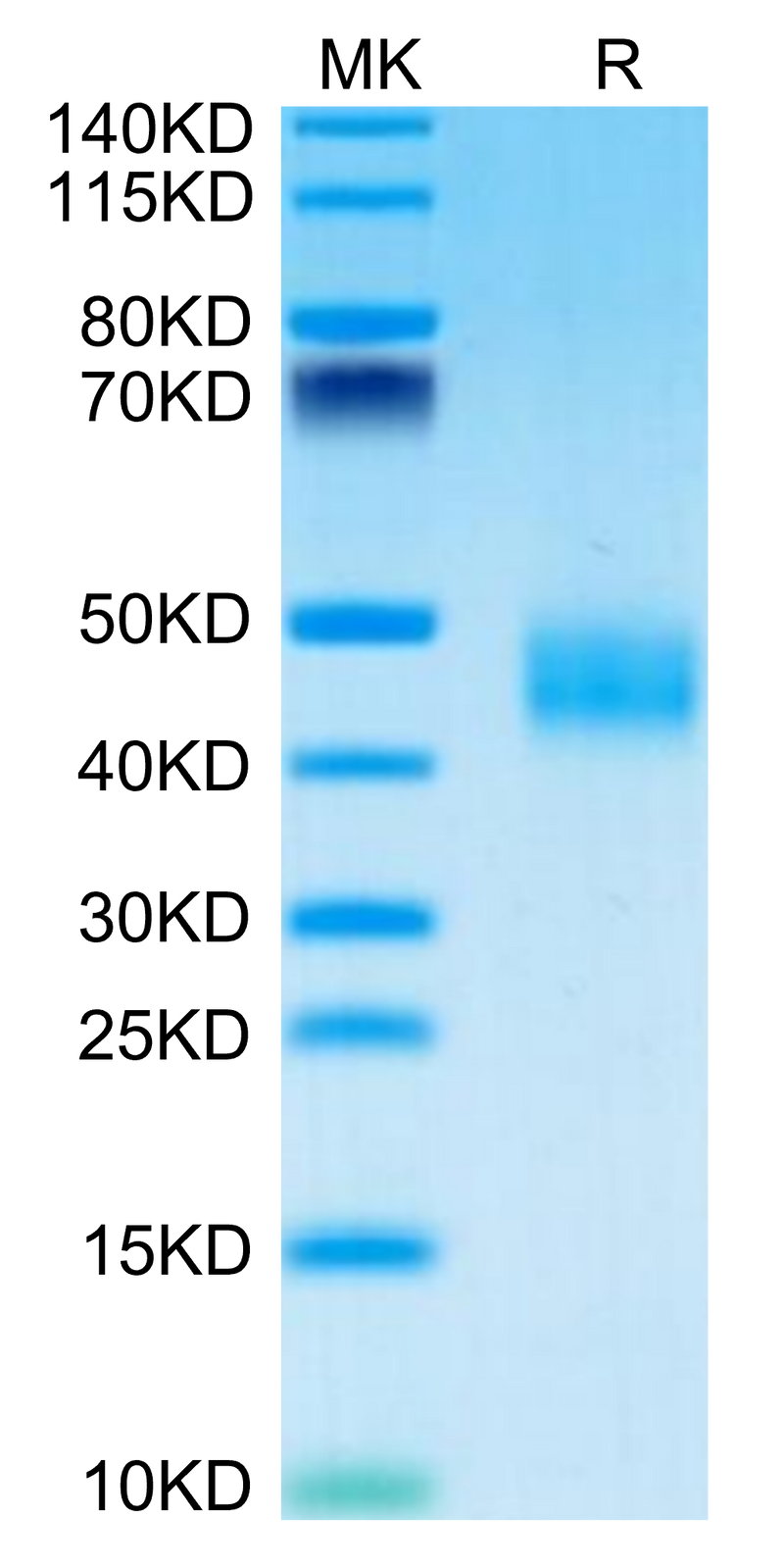 Mouse Galectin 3 on Tris-Bis PAGE under reduced condition. The purity is greater than 95%.Recombinant Mouse Galectin 3 Protein