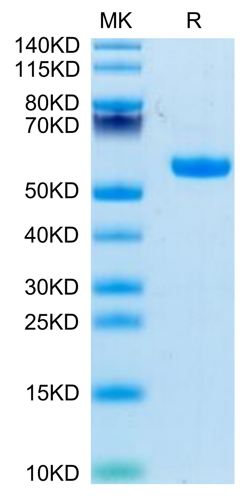 Biotinylated Rhesus macaque CD5 on Tris-Bis PAGE under reduced condition. The purity is greater than 95%.Biotinylated Rhesus macaque CD5 Protein, Active