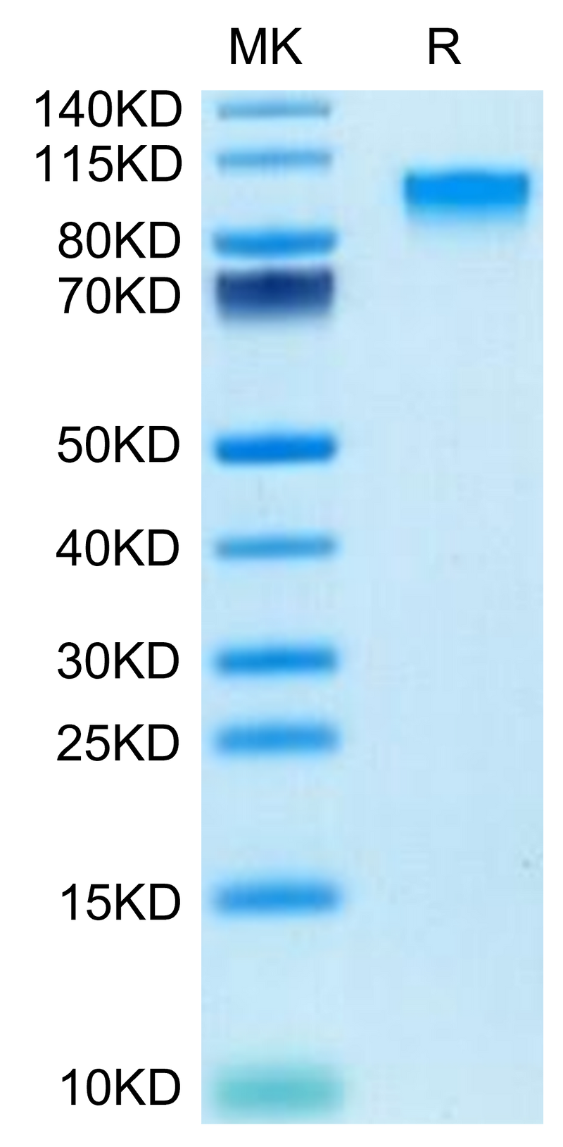 Mouse IL-17R alpha on Tris-Bis PAGE under reduced condition. The purity is greater than 95%.Recombinant Mouse IL-17R alpha/CD217 Protein, Active