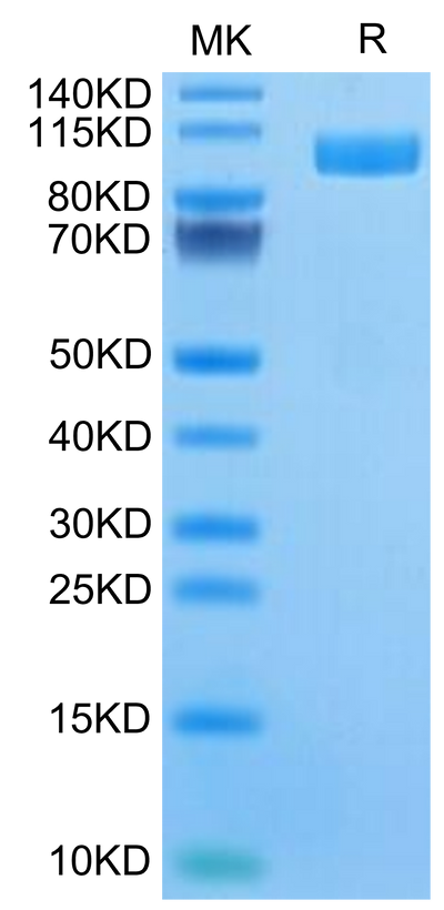 Human ALCAM on Tris-Bis PAGE under reduced condition. The purity is greater than 95%.