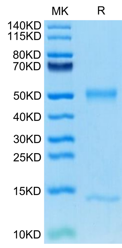 Mouse FcRn on Tris-Bis PAGE under reduced condition. The purity is greater than 95%.Recombinant Mouse FcRn Protein, Active