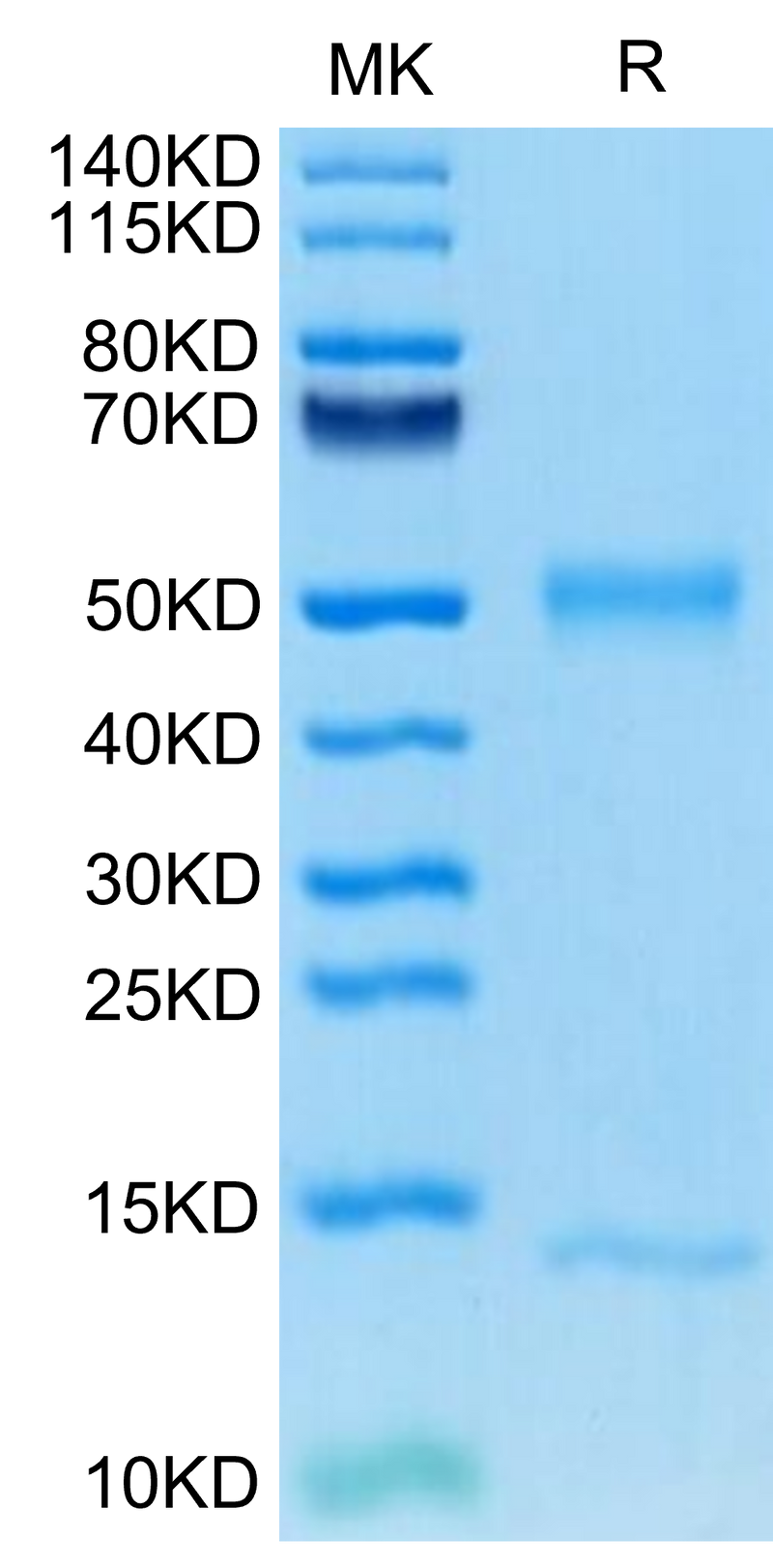 Mouse FcRn on Tris-Bis PAGE under reduced condition. The purity is greater than 95%.Recombinant Mouse FcRn Protein, Active