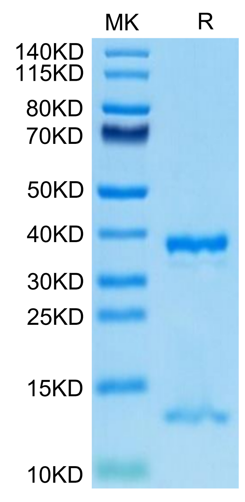 Human FcRn on Tris-Bis PAGE under reduced condition. The purity is greater than 95%.Recombinant Human FcRn Protein, Active