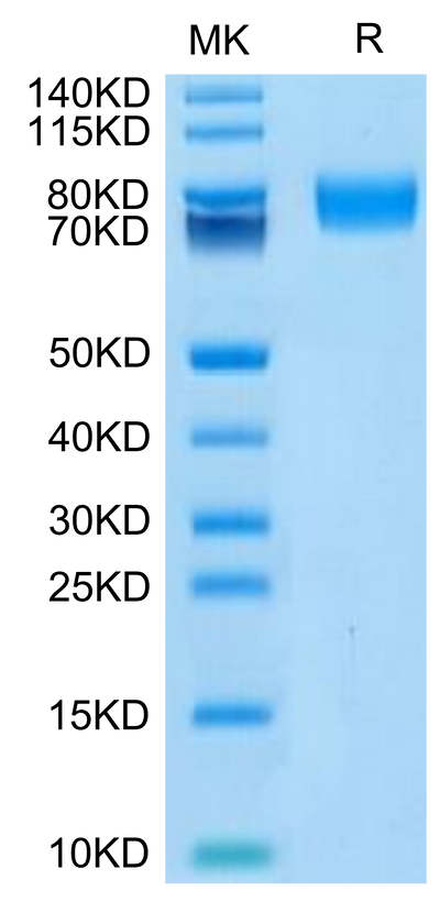 Biotinylated Human ALCAM on Tris-Bis PAGE under reduced condition. The purity is greater than 95%.