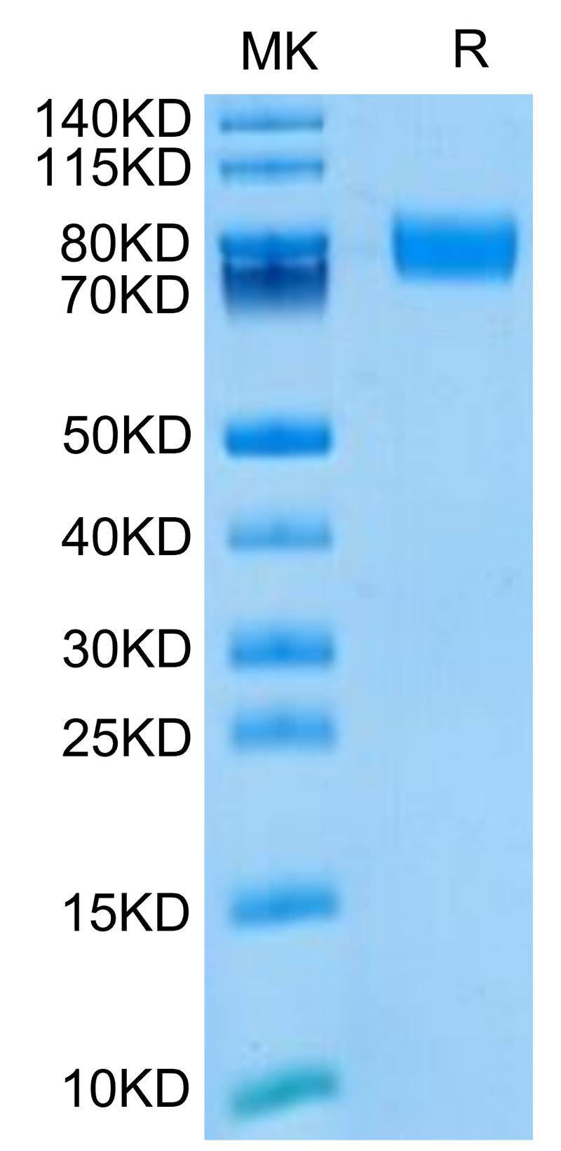 Biotinylated Mouse ALCAM on Tris-Bis PAGE under reduced condition. The purity is greater than 95%.Biotinylated Mouse ALCAM/CD166 Protein, Active