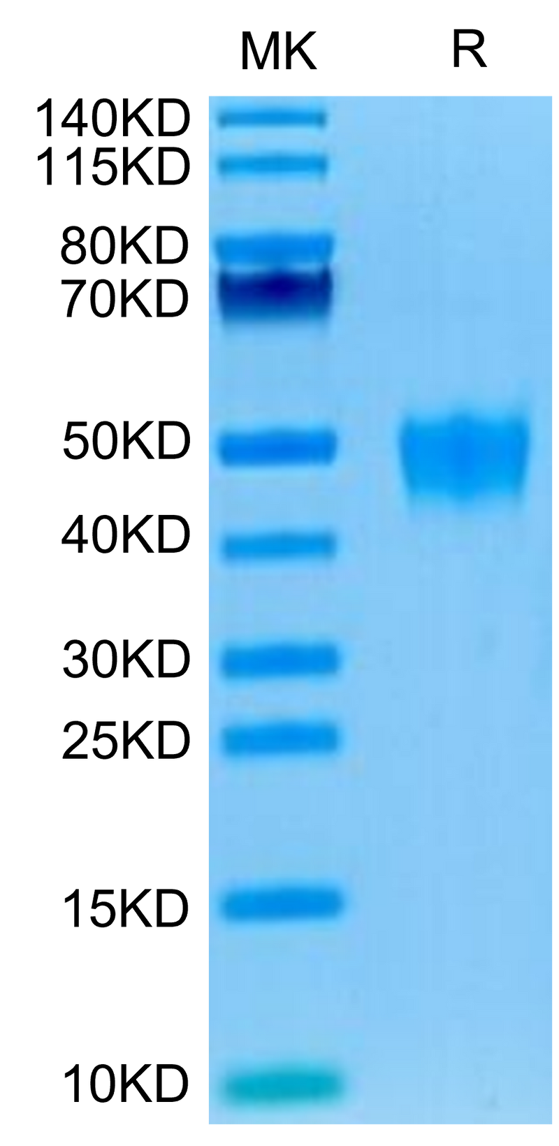 Human KIR2DL5 on Tris-Bis PAGE under reduced condition. The purity is greater than 95%.
