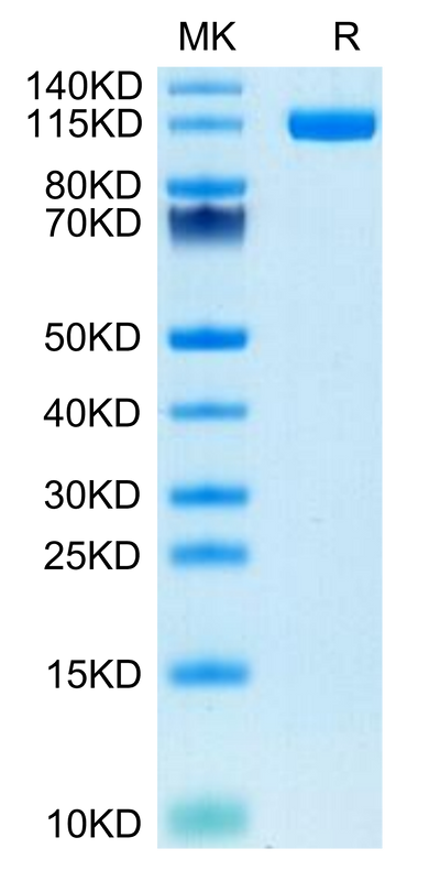 Human ENPP-1 on Tris-Bis PAGE under reduced condition. The purity is greater than 95%.Recombinant Human ENPP-1 Protein, Active