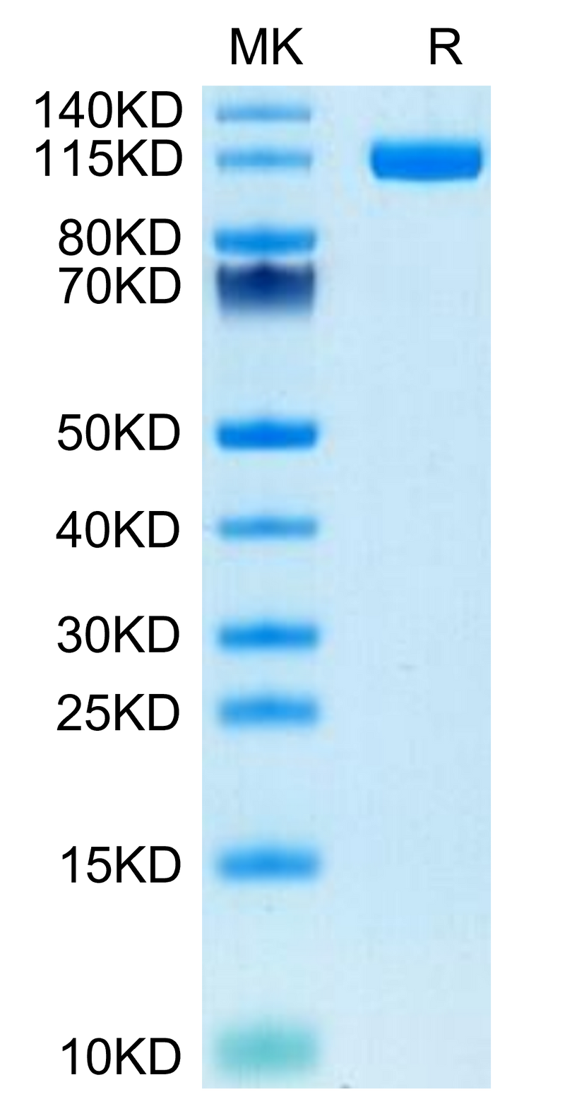 Human ENPP-1 on Tris-Bis PAGE under reduced condition. The purity is greater than 95%.Recombinant Human ENPP-1 Protein, Active