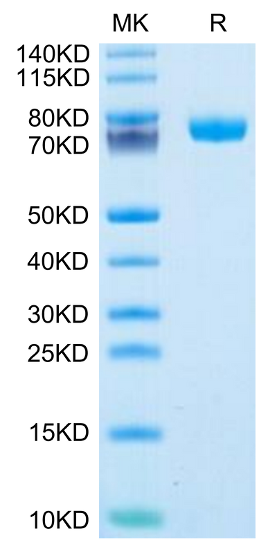 Human FcRH6 on Tris-Bis PAGE under reduced condition. The purity is greater than 95%.Recombinant Human FcRH6 /FCRL6 Protein