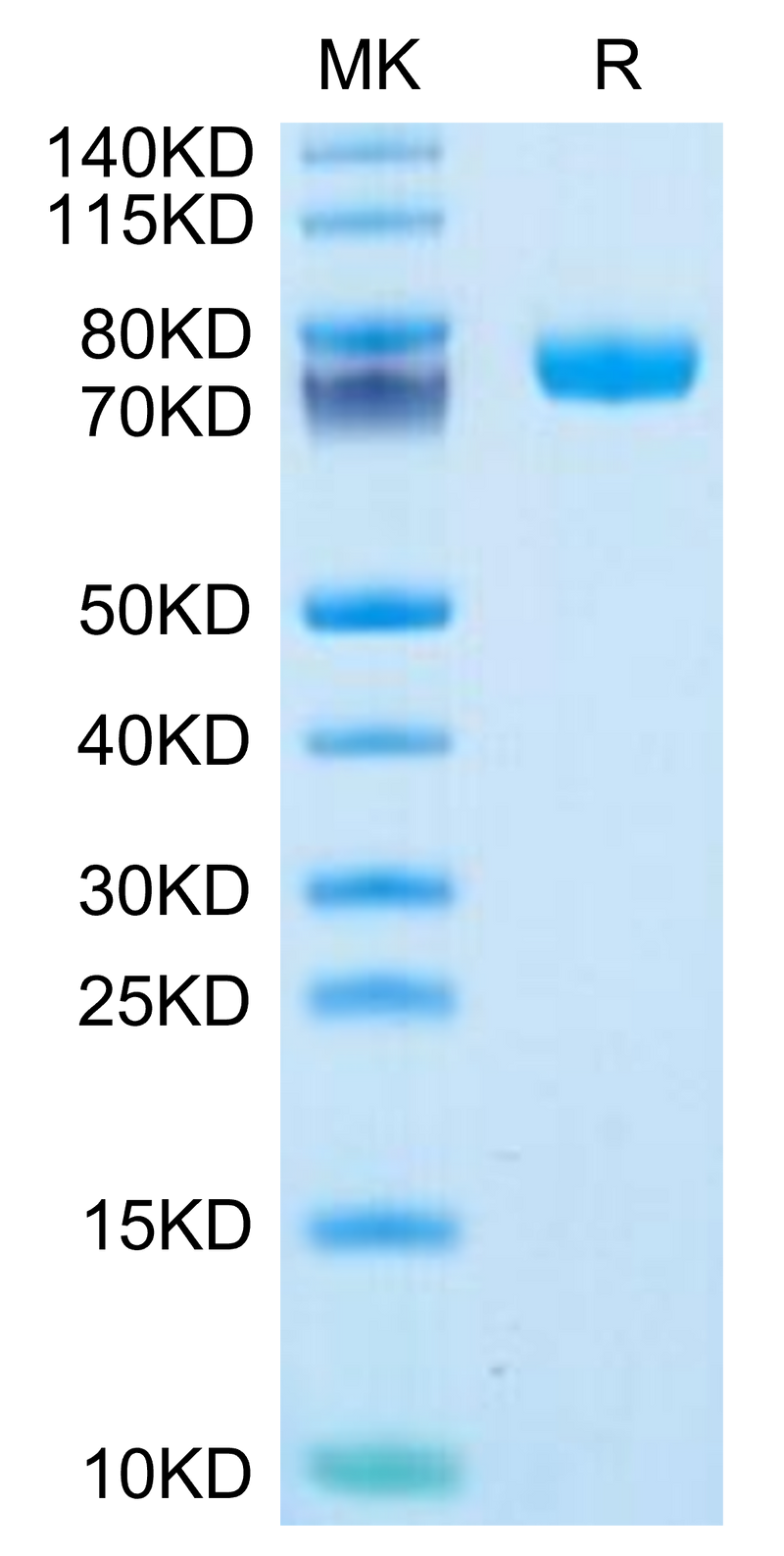 Human FcRH6 on Tris-Bis PAGE under reduced condition. The purity is greater than 95%.Recombinant Human FcRH6 /FCRL6 Protein