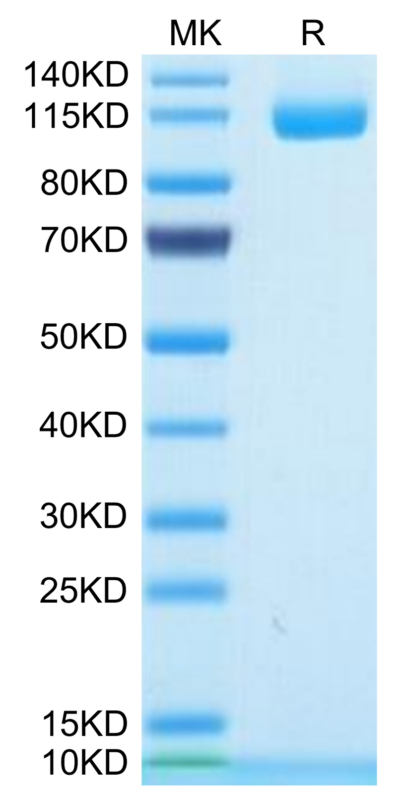 Human ENPP-1 on Tris-Bis PAGE under reduced condition. The purity is greater than 95%.Recombinant Human ENPP-1 Protein, Active